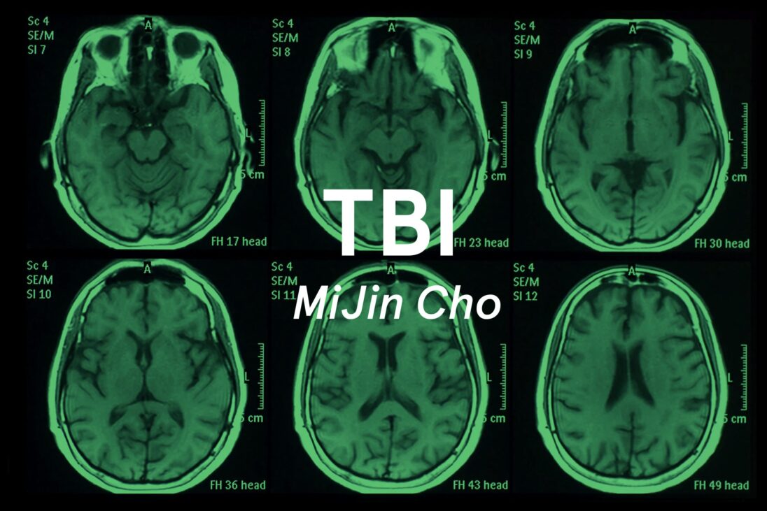TBI
